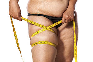 Even in overweight people, these annoying problem areas can be treated with permanent improvement to proportions - Dr. med. Daniel Münch Even in overweight people, these annoying problem areas can be treated with permanent improvement to proportions - Dr. med. Daniel Münch